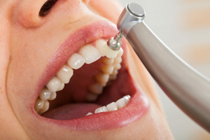 Preventative Advantages Of Regular Dental Checkup And Cleaning